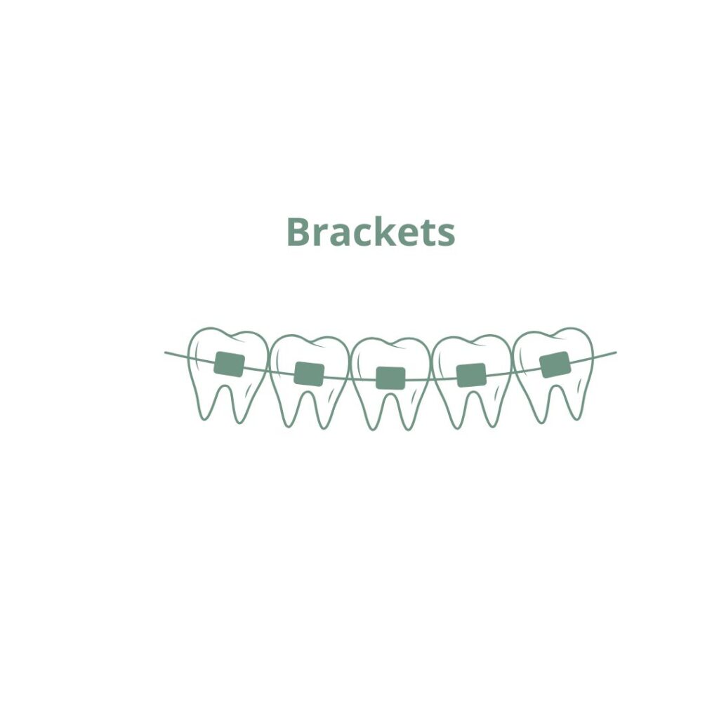 Brackets en Valladolid