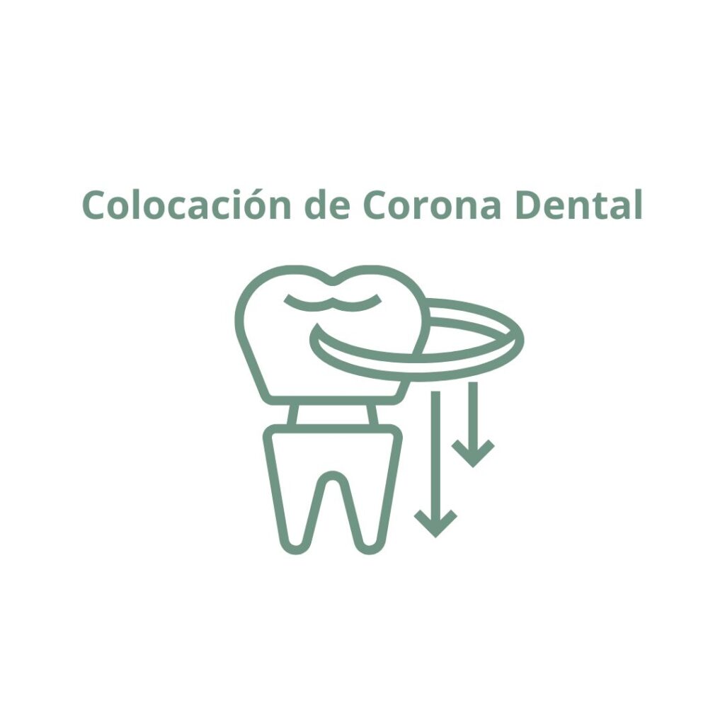 Colocación de la corona dental en Valladolid